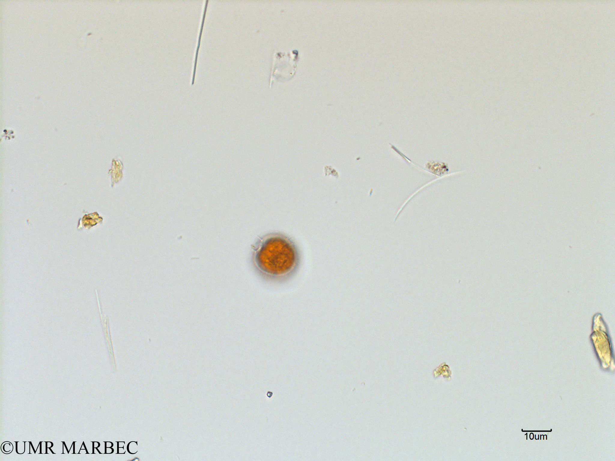phyto/Scattered_Islands/mayotte_lagoon/SIREME May 2016/Protoperidinium sp52 (MAY3_oblea 1-6).tif(copy).jpg